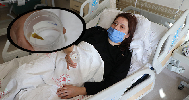 Nefes darlığı ve şiddetli ağrı çeken hastanın ciğerinden Arnavut biberi çıktı