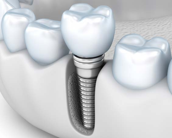dentway (2)